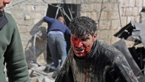 EDITORS NOTE: Graphic content / A wounded Syrian man reacts after fol