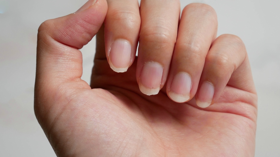 Sabías que las uñas pueden avisar sobre una enfermedad? | Noticias de El  Salvador 