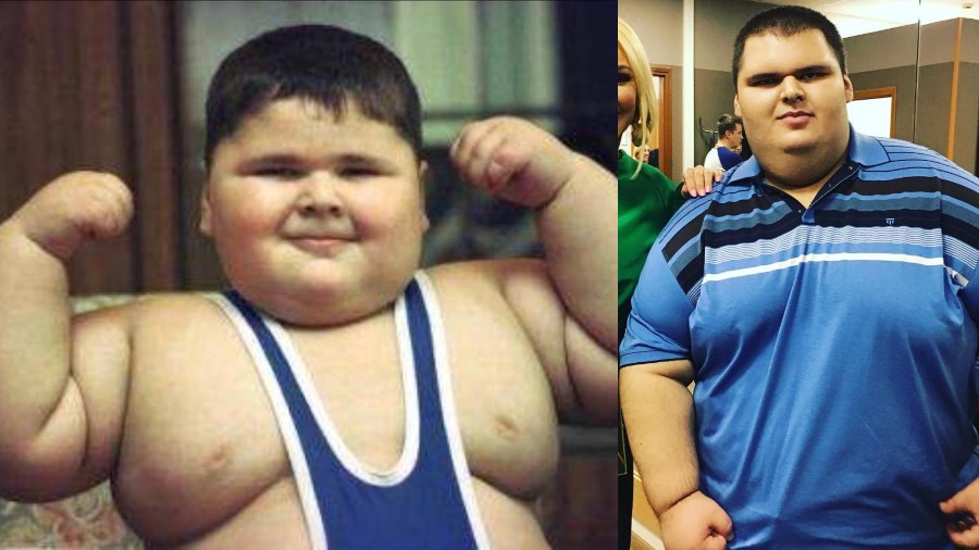 Moere a los 21 años el joven que un día obtuvo un Guinness Record por ser el “niño con más peso del mundo” |  El Salvador News