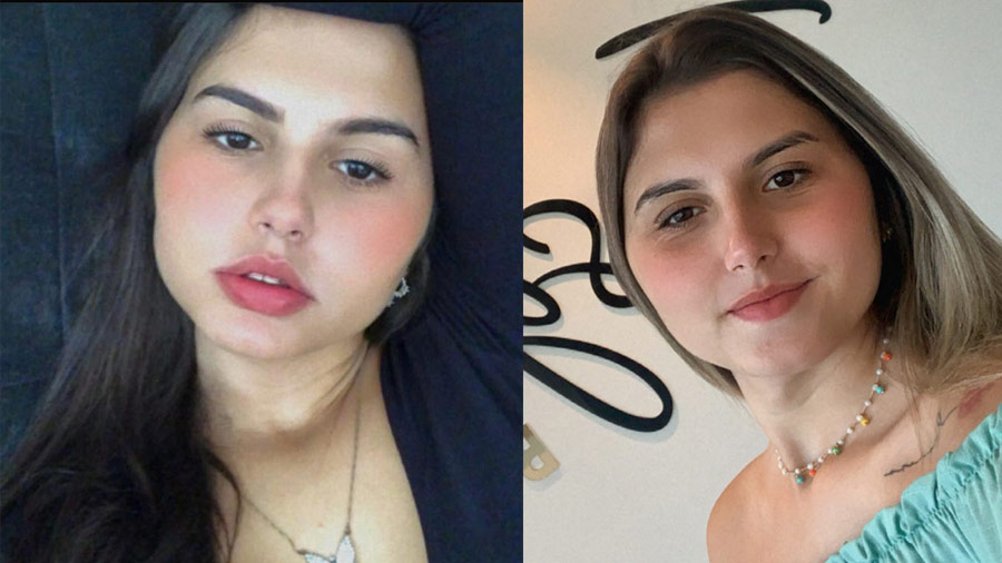 Brazilian trans twins undergo gender reassignment surgery