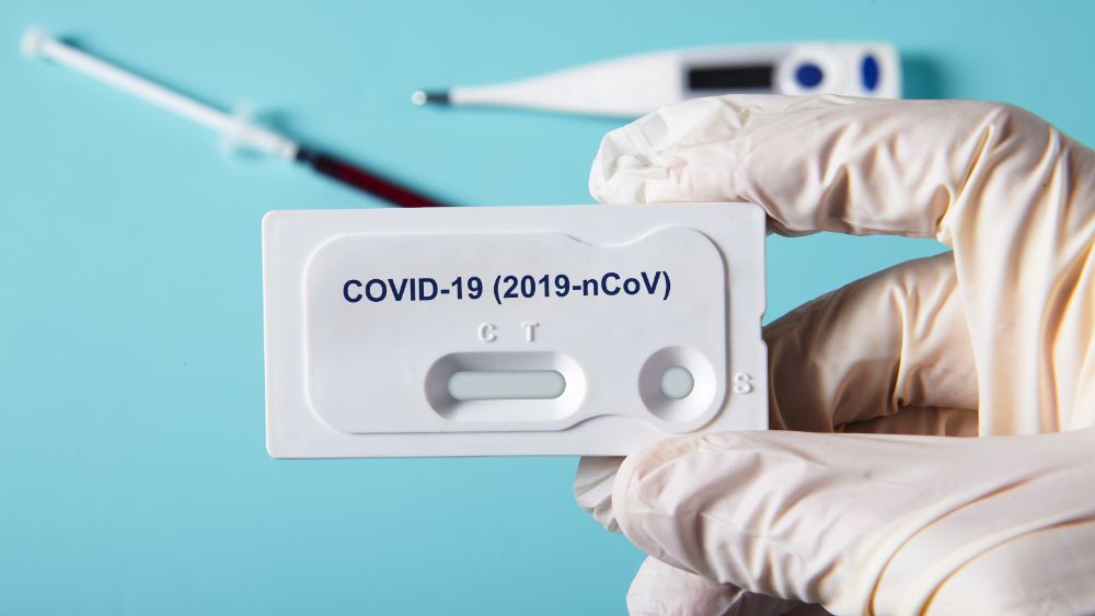 Rapid tests for COVID-19 will now be available in El Salvador  News from El Salvador