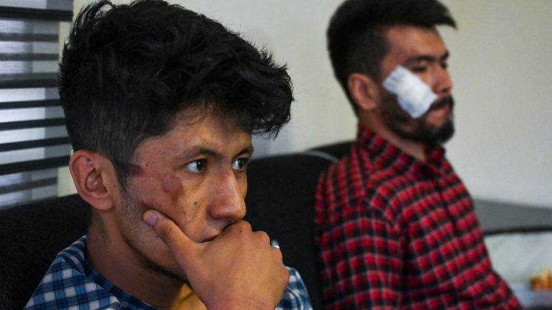 Las cuatro horas infernales de dos periodistas afganos golpeados por los  talibanes | Noticias de El Salvador