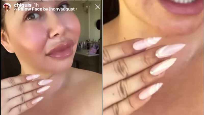 descripci�n de la imagen