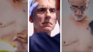 VIDEO. ¡Vaya cambio! Miguel Varoni muestra detalles de su cirugía estética en cara y cuerpo