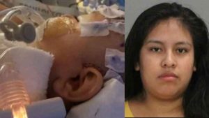 IMÁGENES SENSIBLES: Bebé sufre fractura de cráneo a manos de su niñera porque “no dejaba de llorar”