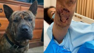 Familia de mujer de 71 años que fue atacada por perro denuncia negligencia de propietarios