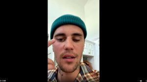 Justin Bieber sufre de parálisis facial por virus
