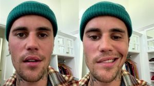 Justin Bieber podría tener una recuperación temprana, asegura especialista