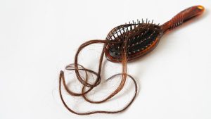 ¿Calvicie? Cuatro sencillas recomendaciones para combatir la caída del cabello