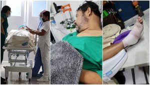 Salud de Cocolito se deteriora por la diabetes