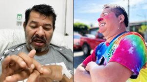VIDEO: Cocolito sufre amputación de dedo del pie por diabetes