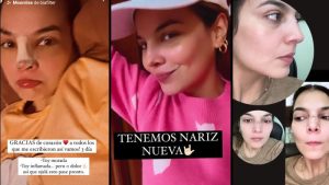 “Me había quedado una nariz ganchuda: Alba Delgado defiende su retoque estético