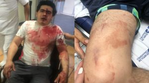 Joven denuncia  golpiza a su novio en canchas de Villa Tuscania