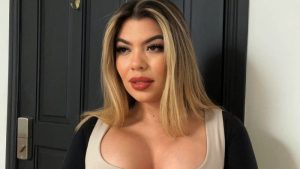 yessica carcamo cirugias plasticas