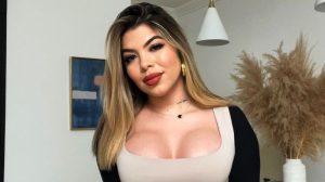 yessica carcamo lipo