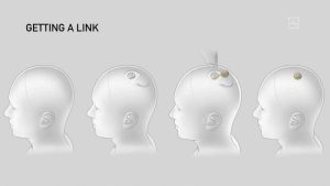 Chip cerebral de Neuralink