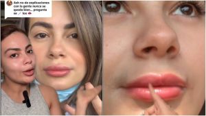 ale costa retoque labios