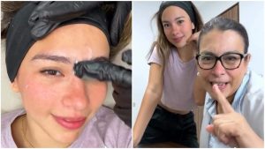 fatima calderon baby botox