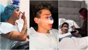 augusto gimenez rinoplastia cirugia estetica