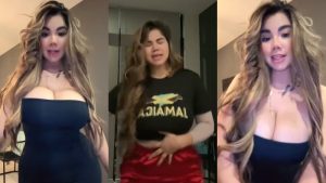 Abigaíl Mancía casi se recupera por completo de su cirugía plástica.