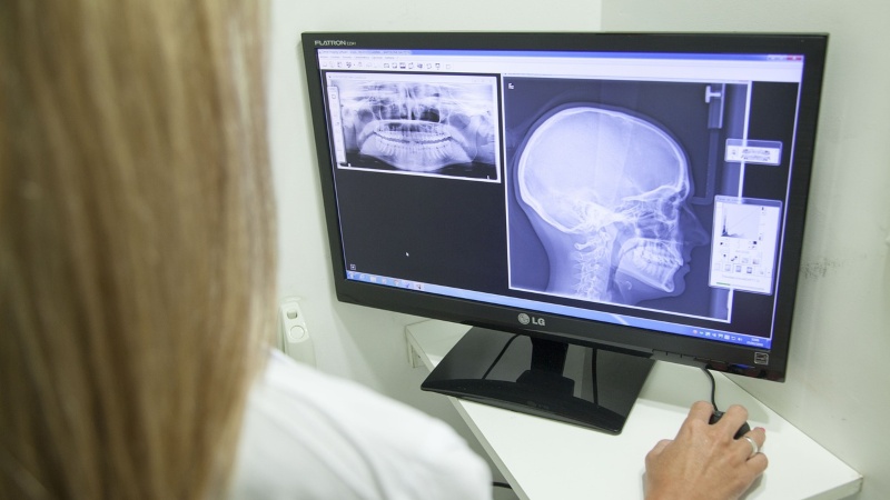 Enfermedad de Parkinson