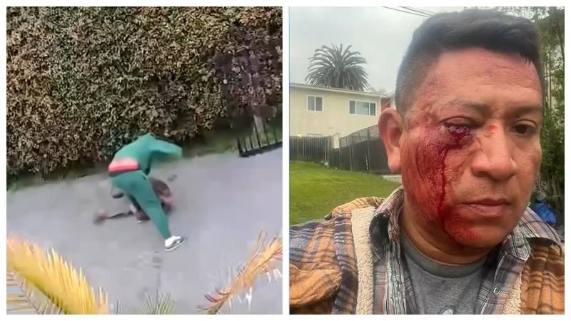 Javier Ibarra, salvadoreño que vive en California, fue atacado a golpes mientras lo insultaba por confundirlo con mexicano | Foto Cortesía.
