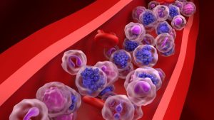 Cuando tus ganglios se inflaman, están hablando. Y tu cuerpo siempre tiene algo importante que decir.