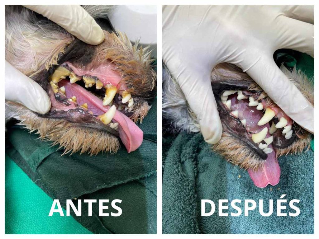 Antes y después de una limpieza dental: más que estética, es salud. Un cambio visible que mejora su bienestar y calidad de vida.