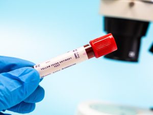 El Ministerio de Salud de Costa Rica confirmó un caso positivo de fiebre amarilla en una turista estadounidense de 29 años que había visitado la región amazónica de Perú y no estaba vacunada.