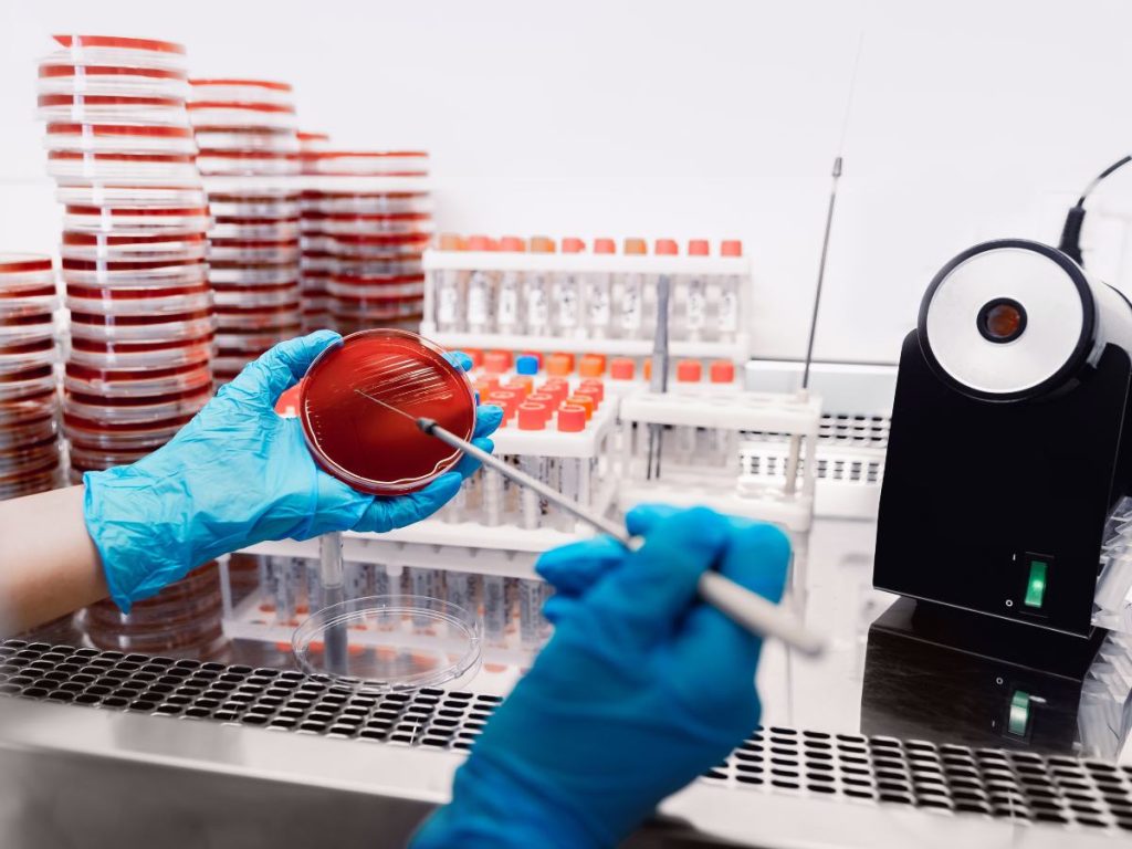 Expertos piden reforzar la educación sanitaria y evitar la automedicación para frenar el avance de bacterias resistentes a los antibióticos en todo el mundo.