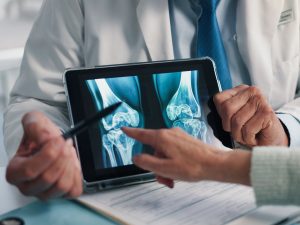 La detección temprana de la osteoporosis permite prevenir fracturas y mantener una buena calidad de vida desde etapas jóvenes.