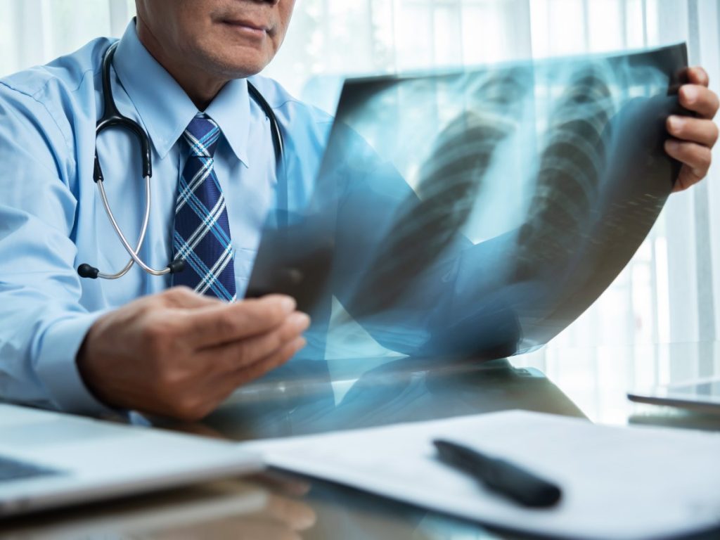 Según estudios realizados se ha identificado el aumento de diagnósticos de cáncer de pulmón sin vínculo directo con el consumo de tabaco.