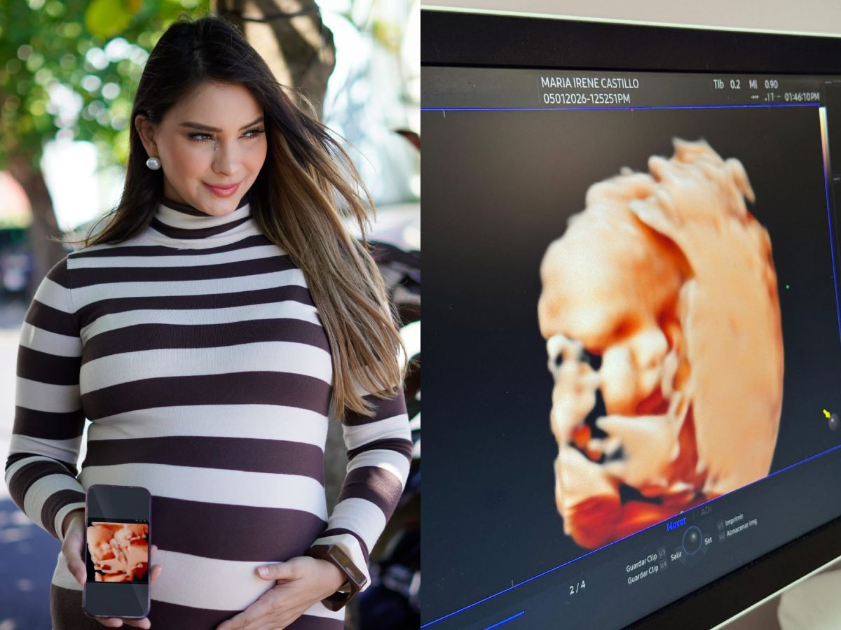 Irene Castillo y Pepe Barahona compartieron nuevas ultrasonografías de su hija Martina, donde ya se distingue claramente su rostro.