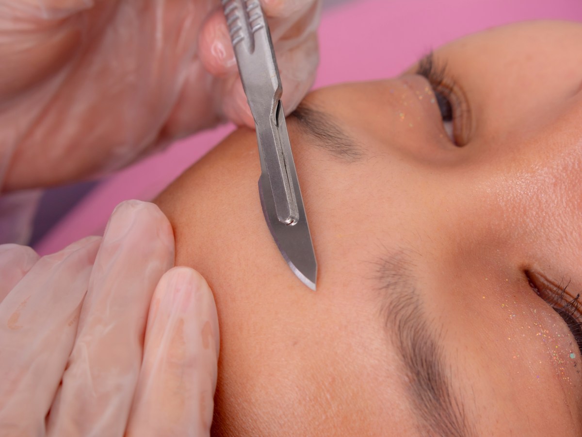El dermaplaning promete una piel más suave, pero expertos advierten que puede dañar la barrera natural del rostro y causar infecciones o cicatrices.
