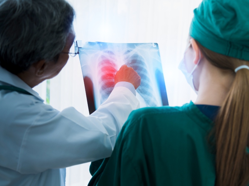 La embolia pulmonar fue confirmada como la causa inmediata de muerte de Catherine O’Hara, según el certificado de defunción.