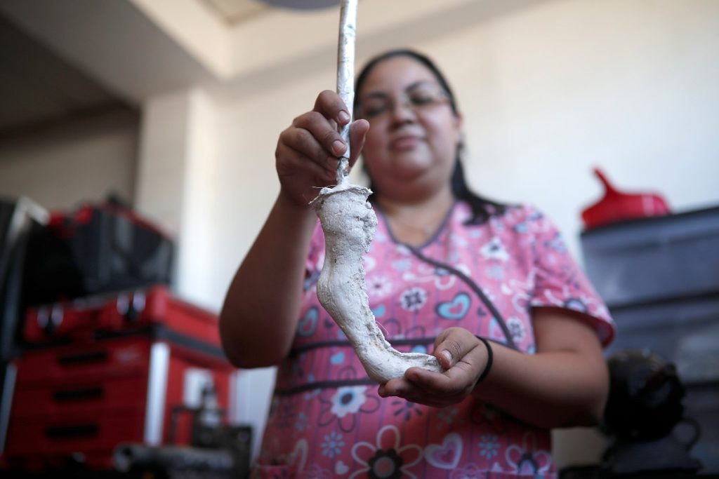 Martha de Ponce, ortesista-protesista de profesión, sosteniendo una de las prótesis que fabrica en San Salvador