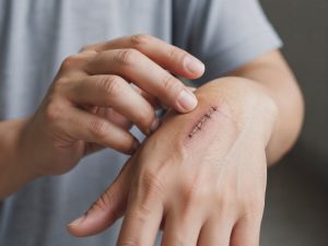 ¿Los humanos pueden regenerar tejidos? Esto dicen los estudios