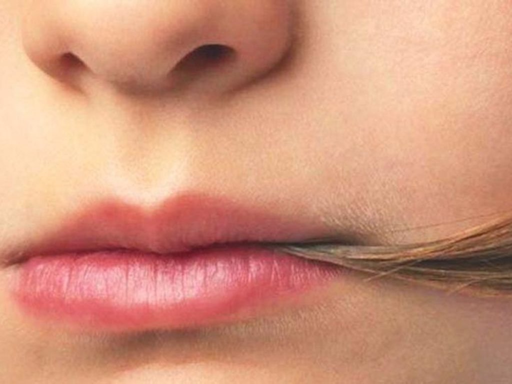 Síndrome de Rapunzel