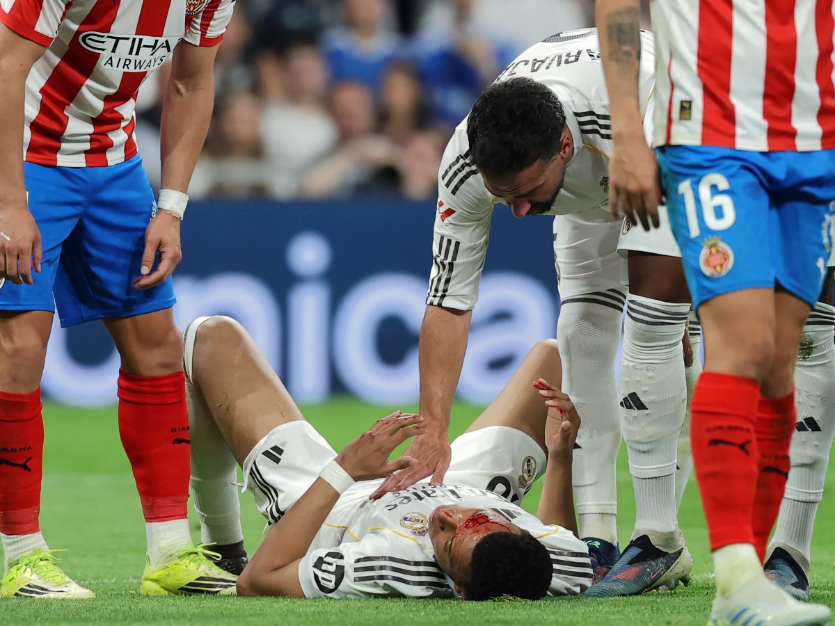 Kylian Mbappé lesionado es duda ante el Bayern Múnich en Champions League. Foto AFP