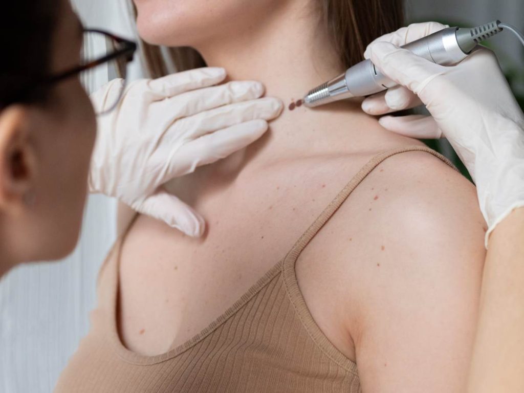 El servicio se brinda en el Mercado Dueñas y el Mercado Central, sin necesidad de cita previa.