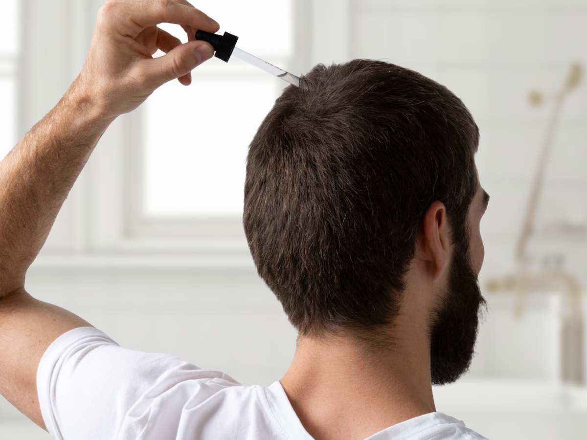 La caída del cabello suele avanzar de forma gradual, por lo que identificar cambios en la línea frontal, coronilla o densidad puede ser clave para buscar un diagnóstico oportuno.