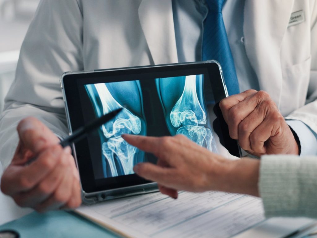 1. Una fractura tras un traumatismo leve puede ser una señal de alerta de osteoporosis, incluso en personas jóvenes, según los especialistas.